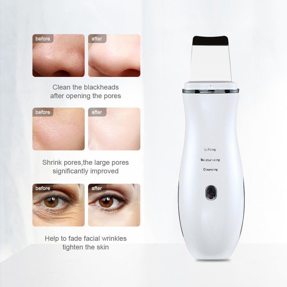Ultrasound Facial Cleansing Device