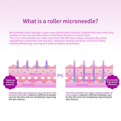 540 Microneedle Scar Derma Roller Dermaroller Micro Needle Skin Care Therapy 1mm