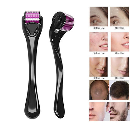 540 Microneedle Scar Derma Roller Dermaroller Micro Needle Skin Care Therapy 1mm
