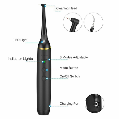 Electric Dental Calculus Remover Tooth Cleaner - salelink.co.nz