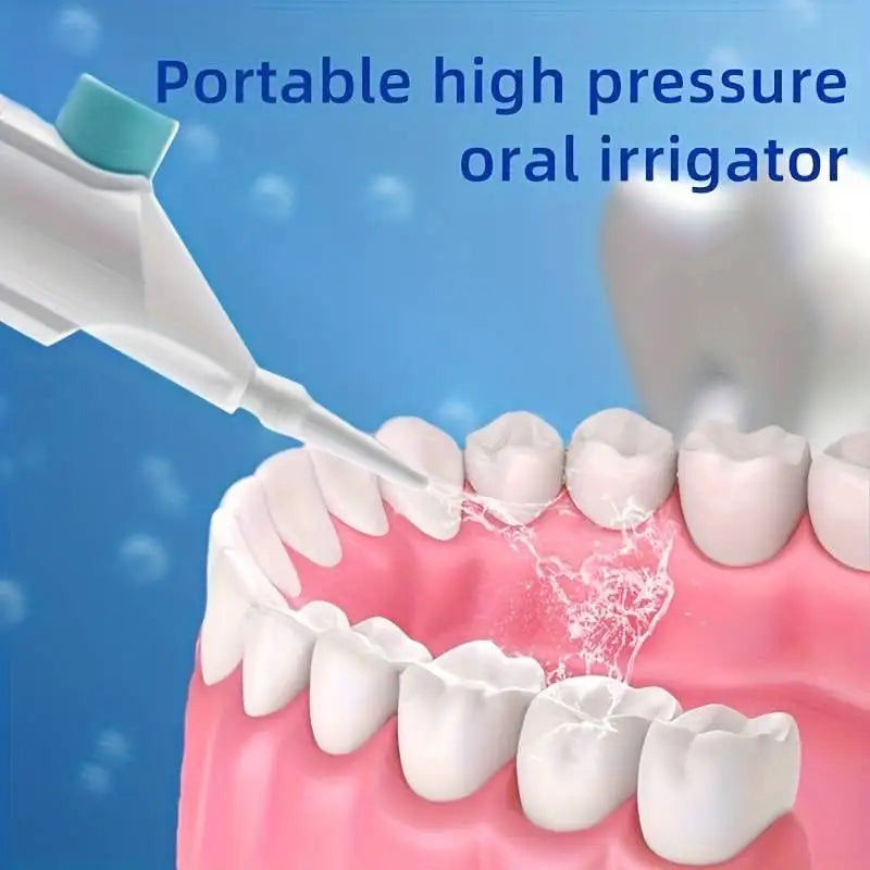 Portable Manual Water Flosser – High Pressure Oral Irrigator for Teeth & Gum Care