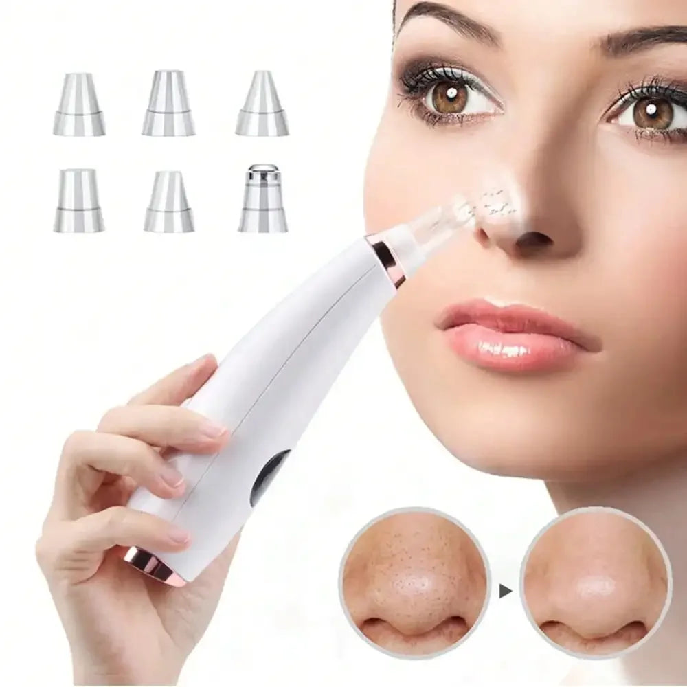 Electric Blackhead Remover – Facial Pore Cleansing Tool