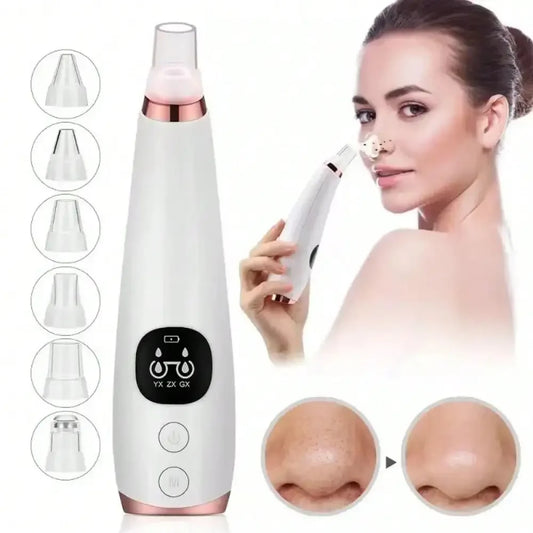 Electric Blackhead Remover – Facial Pore Cleansing Tool