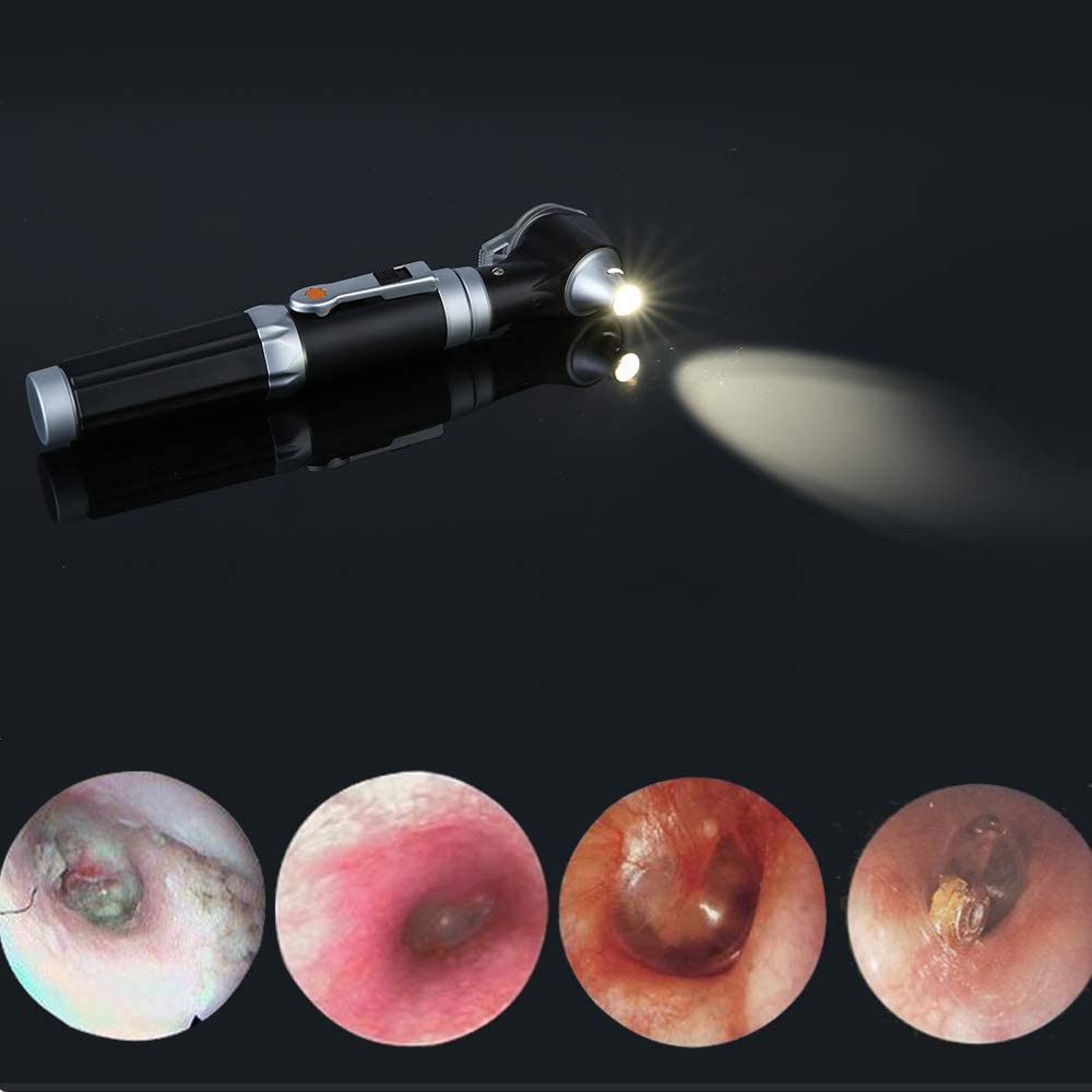 Magnification Diagnostic Ear Scope with LED Direct Illumination Light